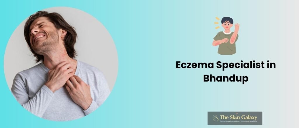 Your Eczema Specialist in Bhandup | The Skin Galaxy