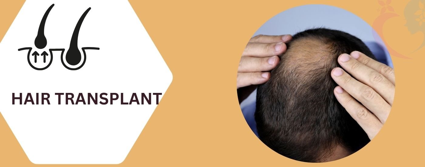 Hair Transplant Procedures | The Skin Galaxy