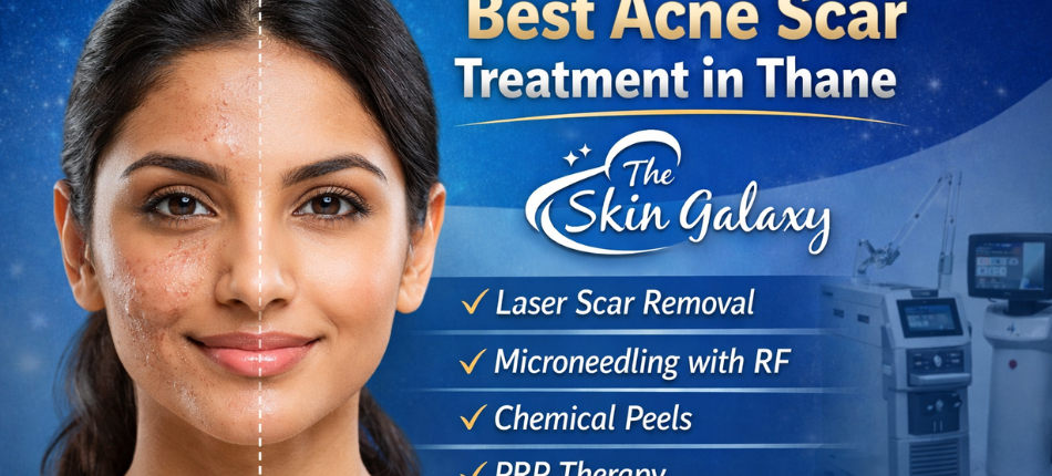 Best Acne Scar Treatment in Thane