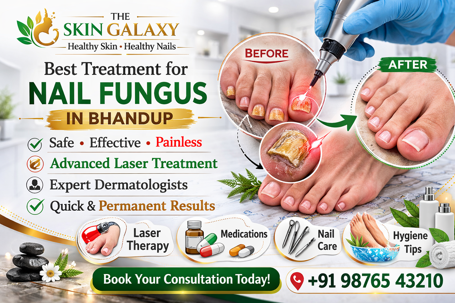 Best Treatment for Nail Fungus in Bhandup